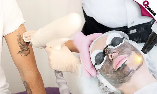 Q-Switch Laser: Carbon Peel, Lip Lightening, Eyebrow Bleaching & More!